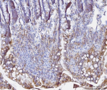 IHC staining of FFPE rat colon tissue with Bid antibody. HIER: boil tissue sections in pH8 EDTA for 20 min and allow to cool before testing.