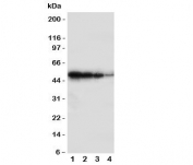 Western blot testing of BMPR1B antbody;  Lane 1: Recombinant human protein 10ng;  2: 5ng;  3: 2.5ng;  4: 1.25ng
