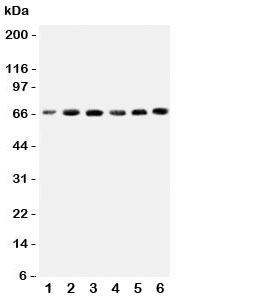 Western blot testing of CETP antbody; Lane 1: HeLa; 2: COLO320; 3: HT1080; 4: Jurkat; 5: Raji; 6: MCF-7 cell lysate. Expected/observed size 66~74KD, depending on glycosylation level