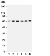 Western blot testing of CETP antbody on human cell lysates 1: HeLa;  2: COLO320;  3: HT1080;  4: Jurkat;  5: Raji;  6: MCF-7 cell lysate.  Expected molecular weight: 66~74 kDa depending on glycosylation level.