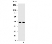 Western blot testing of CXCR5 antibody and Lane 1:  rat spleen;  2: human HeLa cell lysate.  Predicted molecular weight ~43 kDa.