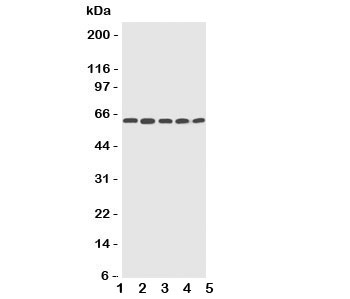Western blot testing of CYP2U1 antibody and Lane 1: HeLa; 2: MCF-7; 3: MM453; 4: COLO320; 5: HT1080 cell lysate~
