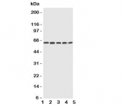 Western blot testing of CYP2U1 antibody and Lane 1:  HeLa;  2: MCF-7;  3: MM453;  4: COLO320;  5: HT1080 cell lysate