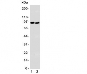 Western blot testing of DISC1 antibody and Lane 1:  U87;  2: SHG-44 cell lysate.  Expected/observed molecular weight: ~94kDa.