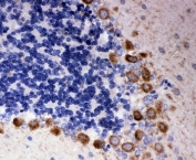IHC-P: DISC1 antibody testing of rat cerebellum tissue. HIER: steamed with pH6 citrate buffer.