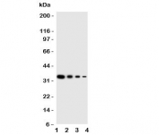 Western blot testing of PKR antbody;  Lane 1: Recombinant human protein 10ng;  2: 5ng;  3: 2.5ng;  4: 1.25ng