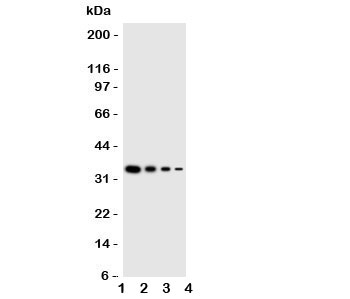 Western blot testing of GCN2 antbody; Lane 1: Recombinant mouse protein 10ng; 2: 5ng; 3: 2.5ng; 4: 1.25ng