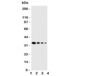 Western blot testing of GCN2 antbody;  Lane 1: Recombinant mouse protein 10ng;  2: 5ng;  3: 2.5ng;  4: 1.25ng