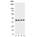 Western blot testing of EIF2S1 antbody; Lane 1: COLO320;  2: CEM;  3: Raji;  4: HT1080 cell lysate.  Predicted molecular weight: 36 kDa.