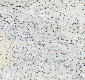 IHC staining of FFPE mouse brain tissue with Flotillin 1 antibody. HIER: boil tissue sections in pH8 EDTA for 20 min and allow to cool before testing.