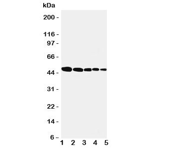 Western blot testing of Flotillin 1 antbody; Lane 1: rat lung; 2: (r) brain; 3: (r) ovary; 4: human SMMC-7721; 5: (h) MFC-7 cell lysate. Expected/observed size ~49KD