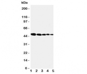 Western blot testing of Flotillin 1 antbody; Lane 1: rat lung;  2: (r) brain;  3: (r) ovary;  4: human SMMC-7721;  5: (h) MFC-7 cell lysate.  Expected/observed molecular weight ~49kDa.