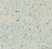 IHC staining of FFPE rat brain tissue with Flotillin 1 antibody. HIER: boil tissue sections in pH8 EDTA for 20 min and allow to cool before testing.