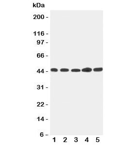 Western blot testing of Hepsin antibody and Lane 1: 293T; 2: NRK; 3: HeLa; 4: PANC; 5: MFC-7 cell lysate. Expected/observed size ~45KD