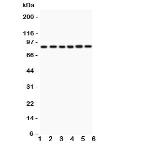 Western blot testing of IKKb antbody and Lane 1: rat heart; 2: (r) skeletal muscle; and human samples 3: PANC; 4: MCF-7; 5: HEPG2; 6: COLO320. Expected/observed size ~87KD