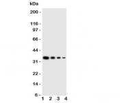 Western blot testing of LAT2 antbody;  Lane 1: Recombinant human protein 10ng;  2: 5ng;  3: 2.5ng;  4: 1.25ng
