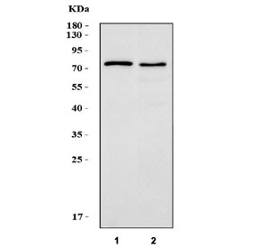 Western blot testing of LPP antbody; Lane 1: SMMC-7721; 2: HeLa; 3: SW620; 4: A549; 5: SKOV; 6: MCF-7 cell lysate