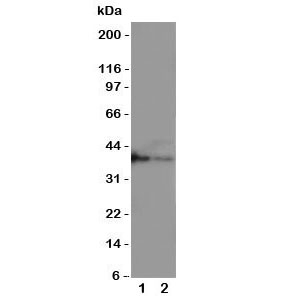 Western blot testing of MBD1 antbody; Lane 1: Recombinant human protein 10ng; 2: 5ng