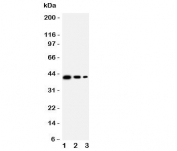 Western blot testing of MBD4 antbody;  Lane 1: Recombinant human protein 10ng;  2: 5ng;  3: 2.5ng