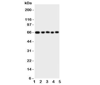 Western blot testing of MBD4 antbody; Lane 1: rat brain; 2: (r) kidney; 3: human A549; 4: (h) HeLa; 5: (h) MCF-7 cell lysate. Expected/observed size ~66KD~