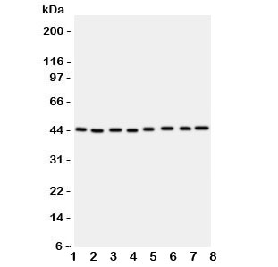 Western blot testing of PGK1 antbody; Lane 1: rat liver; 2: (r) brain; 3: (r) lung; and human samples 4: A431; 5: COLO320; 6: HeLa; 7: A549; 8: Jurkat cell lysate. Expected/observed ~44KD~