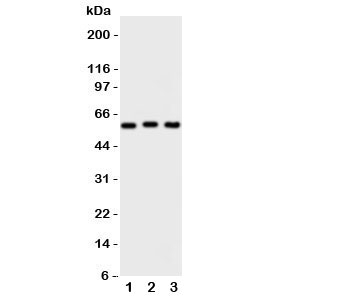 Western blot testing of PKM2 antibody and Lane 1: HeLa; 2: MCF-7; 3: A549 cell lysate