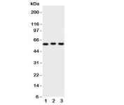 Western blot testing of PKM2 antibody and Lane 1:  HeLa;  2: MCF-7;  3: A549 cell lysate. Predicted molecular weight ~58 KDa.