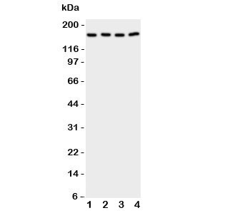 Western blot testing of CPLA2 antibody and Lane 1: rat testis; 2: (r) brain; 3: human A549; 4: (h) COLO320 cell lysate. Expected size 85~110KD, observed size ~160KD