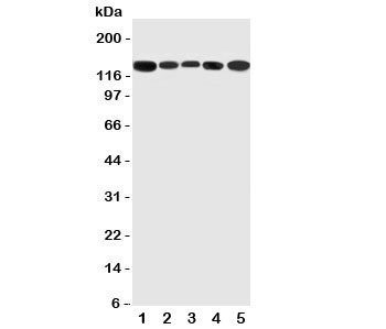 Western blot testing of RGS3 antibody and Lane 1: rat testis; 2: (r) brain; 3: (r) spleen; 4: human HeLa; 5: (h) U87 cell lysate~