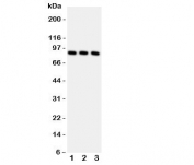 Western blot testing of RSK1 antbody and Lane 1: A431;  2: MCF-7;  3: HeLa.  Predicted molecular weight: 83~90 kDa.