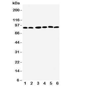 Western blot testing of RSK1 antbody; Lane 1: MCF-7; 2: HeLa; 3: K562; 4: Jurkat; 5: SW620; 6: Raji cell lysate. Predicted/observed size 83~90KD~
