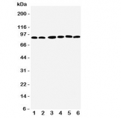Western blot testing of RSK1 antbody;  Lane 1: MCF-7;  2: HeLa;  3: K562;  4: Jurkat;  5: SW620;  6: Raji cell lysate.  Predicted molecular weight: 83~90 kDa.