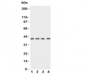 Western blot testing of p53R2 antbody; Lane 1: rat thymus;  2: human MCF-7;  3: (h) A431;  4: (h) HeLa cell lysate.  Expected/observed size ~40KD