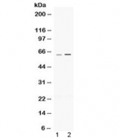 Western blot testing of 1) rat heart and 2) mouse thymus lysate (50ug/lane) with p63 antibody. Expected molecular weight: 63-77 kDa.