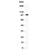 Western blot testing of Prothrombin antbody and rat testis lysate;  Predicted molecular weight: 70 kDa, but may be observed at higher molecular weights due to glycosylation.