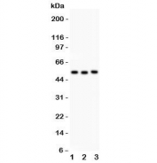 Western blot testing of Factor VII antbody and human Lane 1: SMMC-7721;  2: Jurkat;  3: Raji lysate;  Predicted molecular weigh ~51 kDa but may be observed at higher molecular weights due to glycosylation.