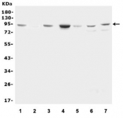 Western blot testing of 1) rat kidney, 2) rat lung, 3) rat heart, 4) mouse kidney, 5) mouse lung, 6) human HeLa and 7) human HepG2 lysate with Factor VIII antibody. Predicted molecular weight ~92 kDa.