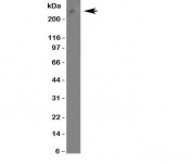 Western blot testing of ABCA4 antibody in U87 cell lysate. Predicted molecular weight ~256 kDa but may be observed at higher molecular weights due to glycosylation.