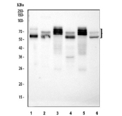 Western blot analysis of ABI2 in 1) human SH-SY5Y, 2) human 293T, 3) rat brain, 4) PC-12, 5) mouse brain, and 6) Neuro-2a lysates. The ABI2 antibody detects a major band at approximately 56 kDa in all samples, corresponding to the predicted size of Abl interactor 2, together with additional bands between ~60 and 75 kDa in brain and neuronal lysates. Multiple ABI2 species in this range have been reported in mouse brain and are attributed to alternatively spliced isoforms and post translationally modified forms of ABI2, consistent with its role as a heavily phosphorylated WAVE complex component.