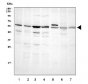 Western blot testing of ABI2 antibody; Lane 1: rat brain;  2: human placenta;  3: MCF-7;  4: HeLa;  5: Jurkat cell lysate. Predicted molecular weight ~55 kDa.