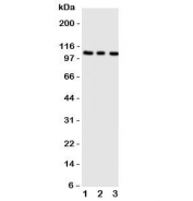 Western blot testing of ADAMTS1 antibody;  Lane 1: rat liver;  2: (r) heart;  3: (r) brain tissue lysate.  Predicted molecular weight 84~120 kDa depending on glycosylation and processing.
