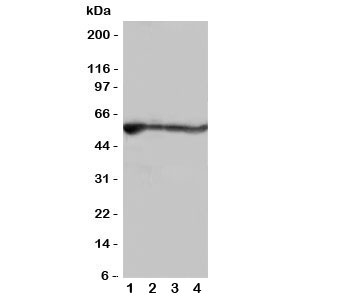 Western blot testing of ALDH2 antibody and rat samples; Lane 1: liver; 2: intestine; 3: lung; 4: kidney tissue lysate~