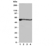 Western blot testing of ALDH2 antibody and rat samples; Lane 1: liver;  2: intestine;  3: lung;  4: kidney tissue lysate. Predicted molecular weight: ~56kDa.