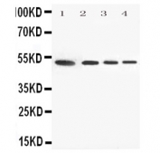 Western blot testing of human 1) HeLa, 2) A549, 3) SMMC-7721 and 4) HT1080 cell lysate with Annexin VII antibody. Predicted molecular weight ~52 kDa.