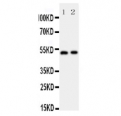 Western blot testing of human 1) SMMC-7721 and 2) COLO-320 cell lysate with Annexin VII antibody. Predicted molecular weight ~52 kDa.