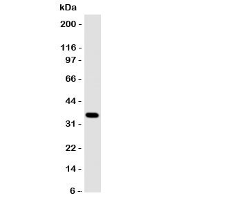 Western blot testing of Annexin A10 antibody and A549 cell lysate~