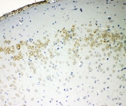 IHC-P: VE Cadherin antibody testing of rat brain tissue