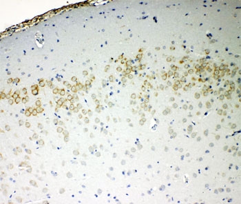 IHC-P: VE-Cadherin antibody testing of rat brain tissue