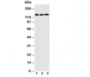 Western blot testing of VE Cadherin antibody;  Lane 1: A549;  2: HeLa;  3: MCF-7 cell lysate. Expected molecular weight: 90~140 kDa depending on glycosylation level.
