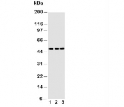 Western blot testing of CXCR4 antibody;  Lane 1: M231;  2: MCF-7;  3: Jurkat cell lysate. Predicted molecular weight ~40 kDa but may be observed at higher molecular weights due to glycosylation.